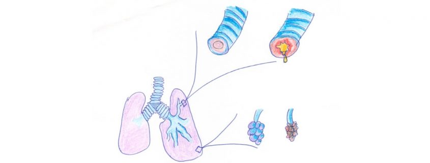 Fysiotherapie en COPD