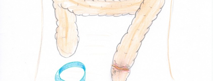 Fysiotherapie bij darmkanker