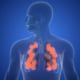 Fysiotherapie bij longfibrose. In deze blog lees je wat longfibrose is, wat fysiotherapie bij longfibrose kan betekenen en wat je zelf kunt doen om zo actief mogelijk te blijven.